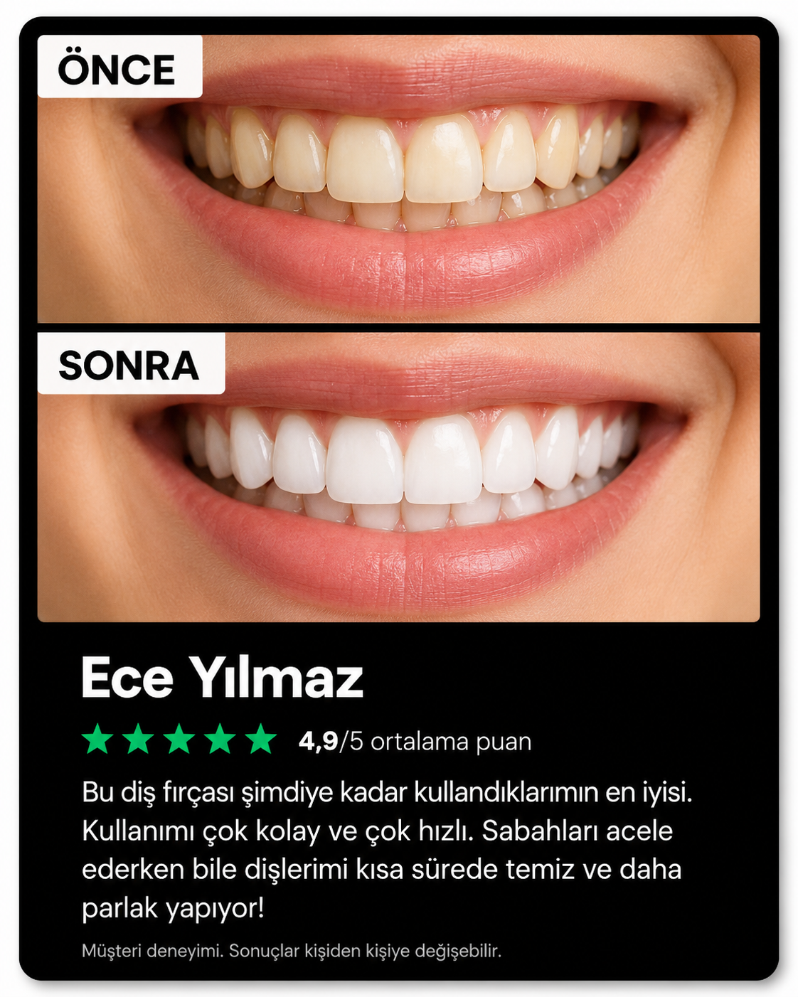Denta360™